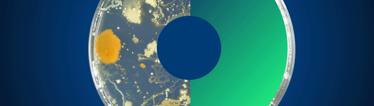 Parceria Europeia One Health – Antimicrobial Resistance lança o 1º Concurso Transnacional